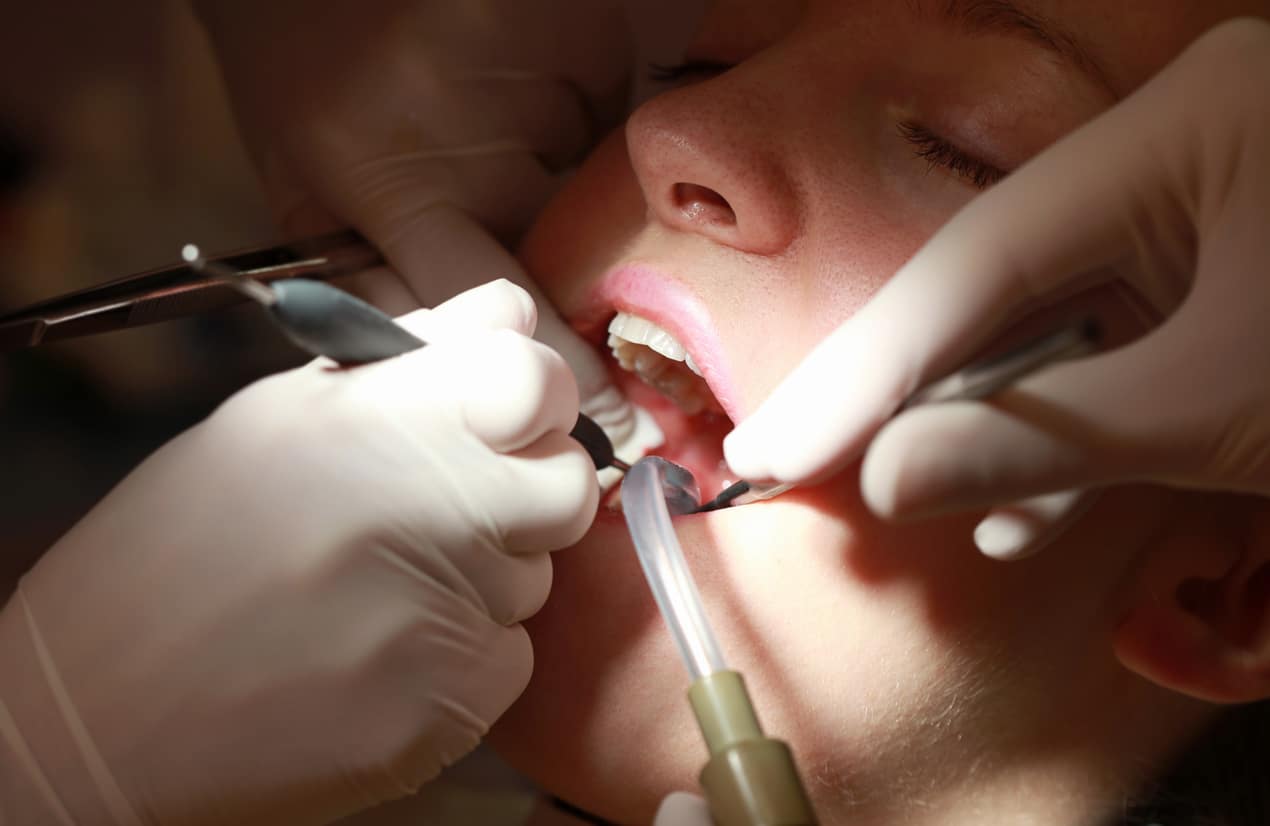Woman getting a dental procedure