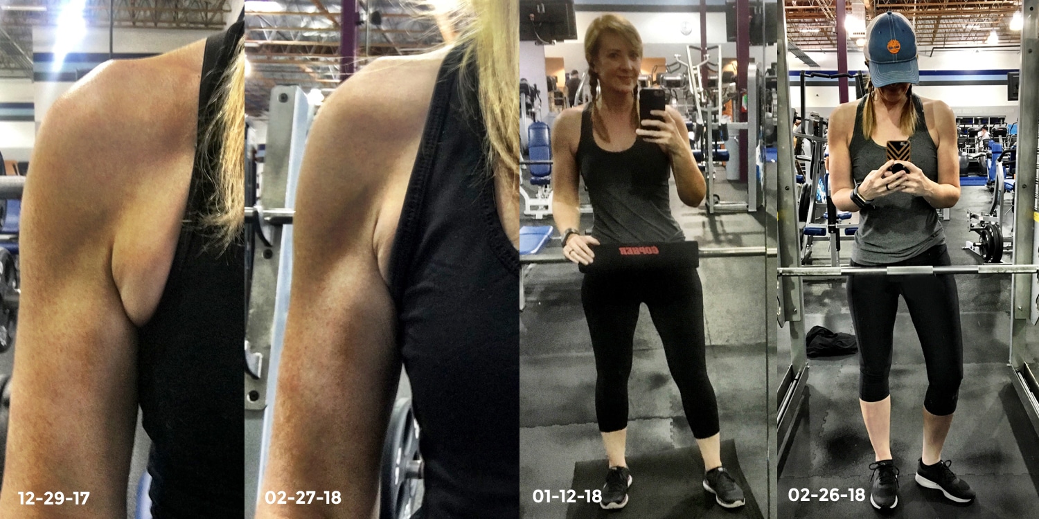 5 Easy Exercises to Alleviate Underarm Fat