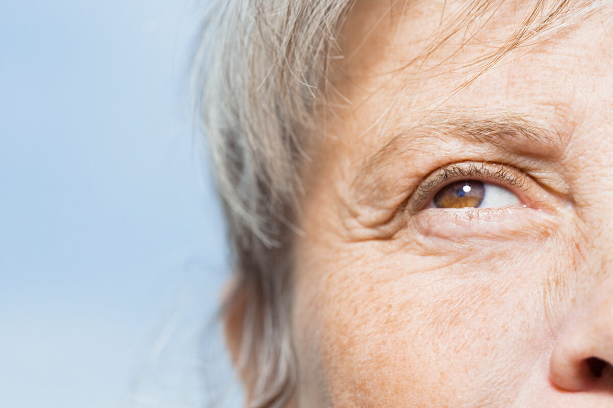 thinning or fading eyebrows, eye wrinkles, anti-aging