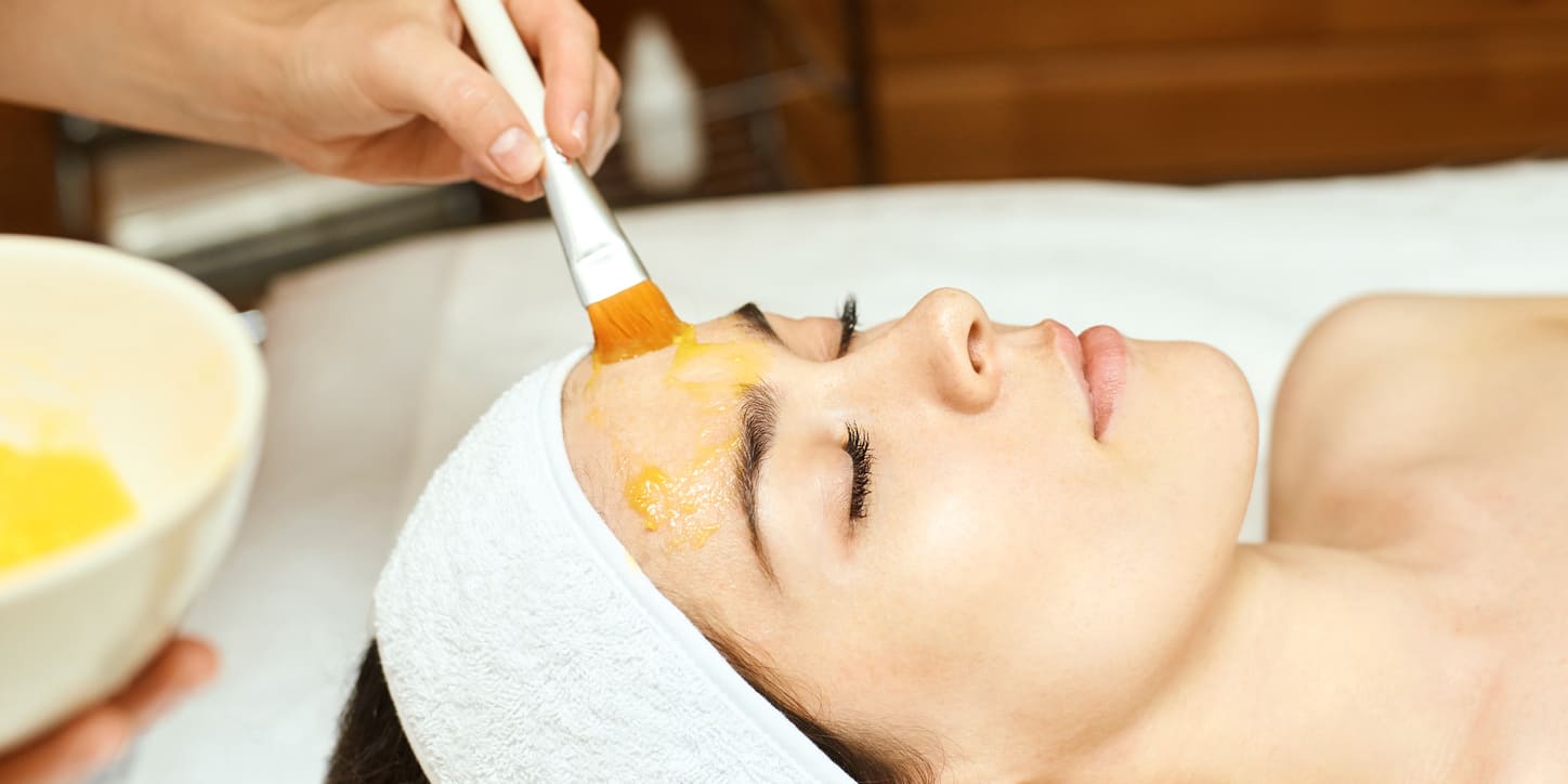 Chemical peel for hyperpigmentation and other skin issues