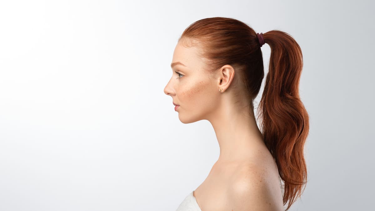 Hair loss caused by a tight ponytail;