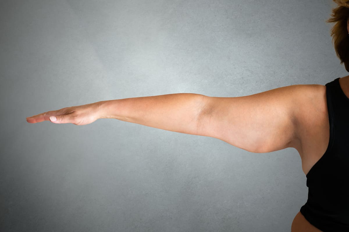 chicken wing arm