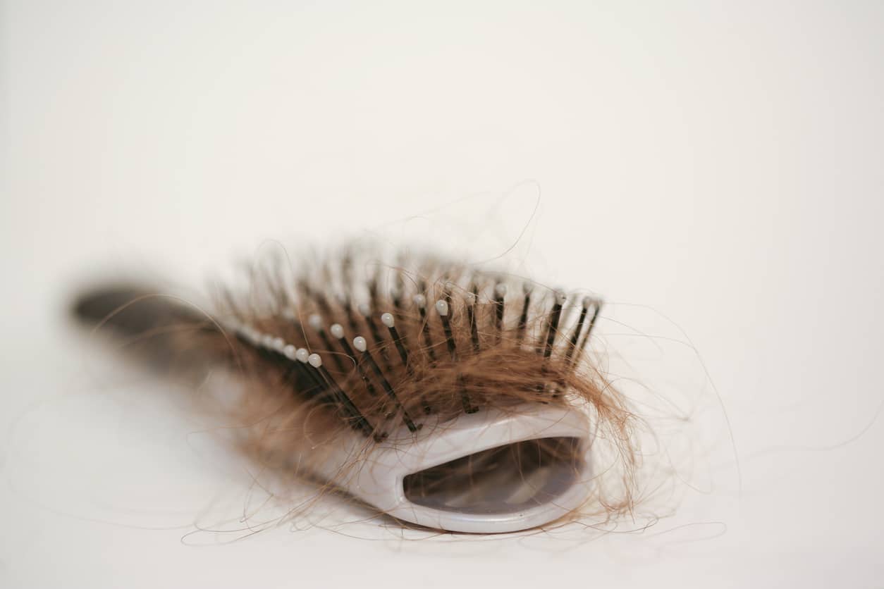 Hairbrush with lots of hair to indicate hair loss