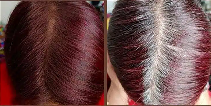 Style Edit review gray hair thinning hairline