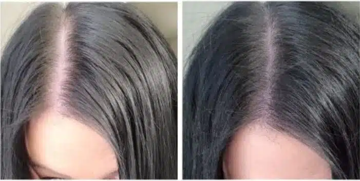 Style edit thinning hairline
