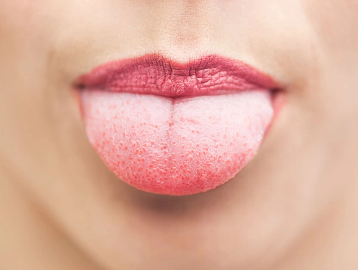 tongue exercise for face