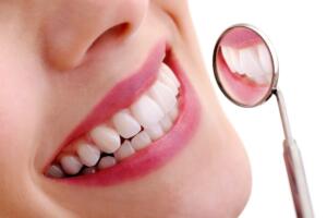 Teeth whitening feature