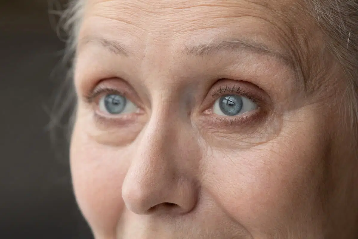 aging face