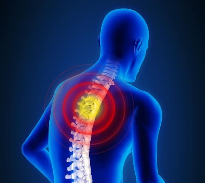 what causes a hunchback