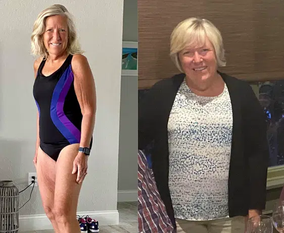 DoFasting Betsy before and after