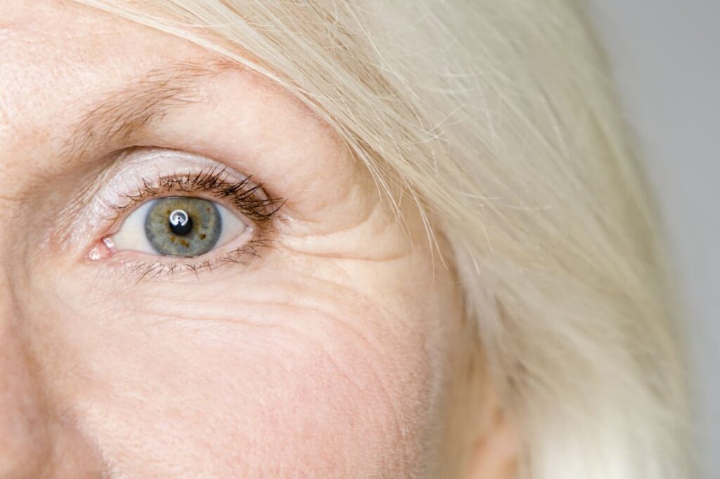what causes wrinkles under eyes close up of eye