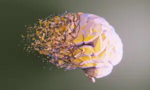 The Effects of High Body Fat on Your Brain