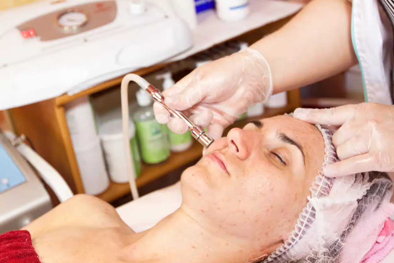 Dermabrasion - dermatologic surgery