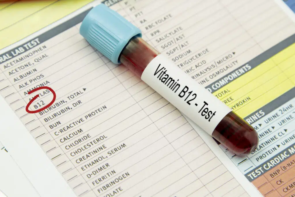 Preventing B12 Deficiency