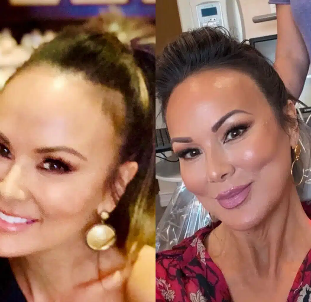 Tiffany Hendra before and after