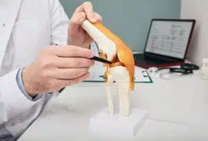 Meniscus Tear and Other Exercise-Related Injuries