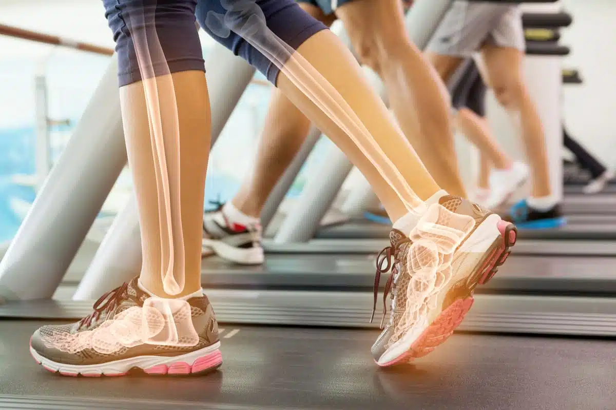 healthy bones