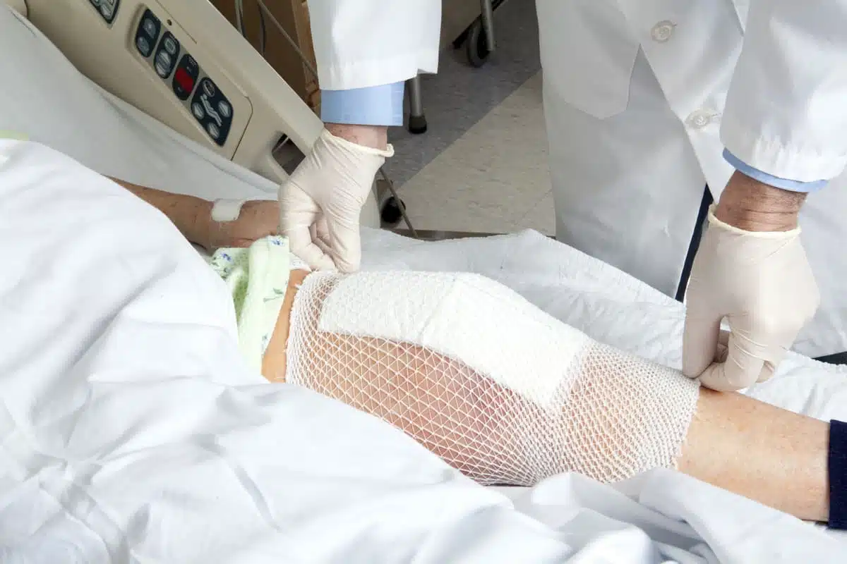 knee replacement post surgery