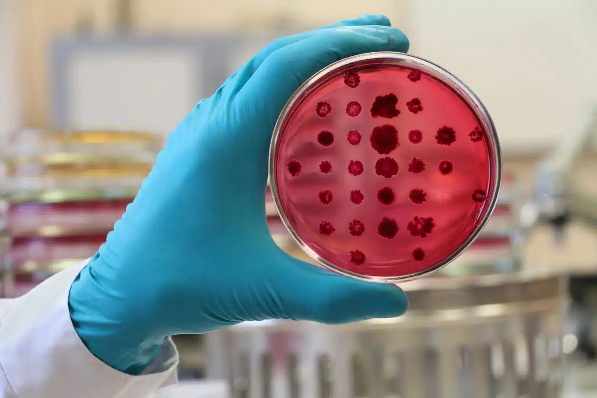 scientist looking at petri dish