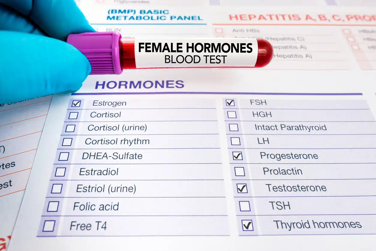 Blood test estrogen or female hormones
