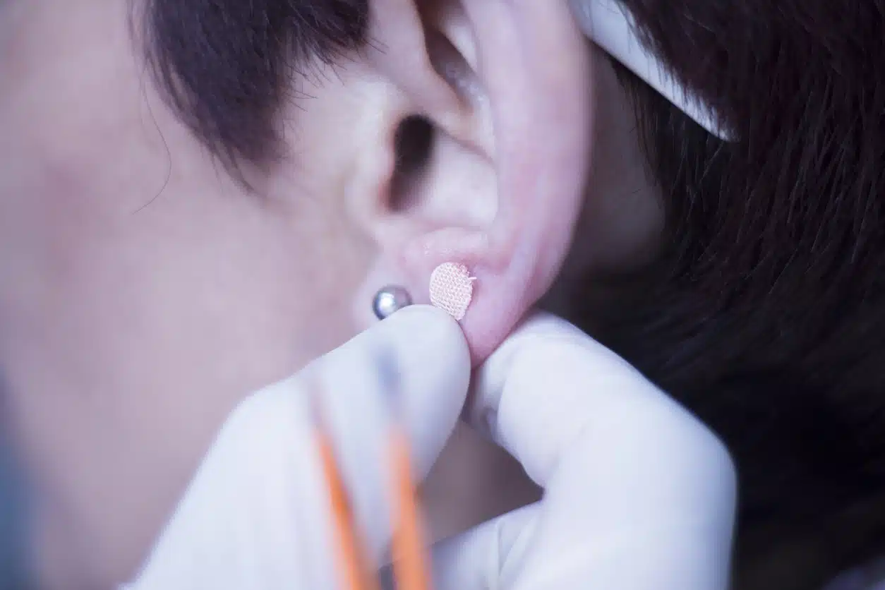 Auricular therapy acupunture ear seed sticker plaster