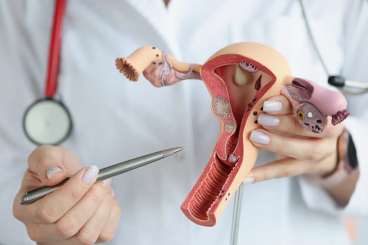 Doctor holding a sectional model of the female reproductive organs