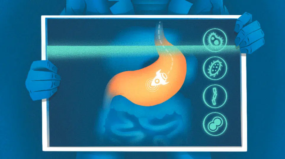 Viome gut health