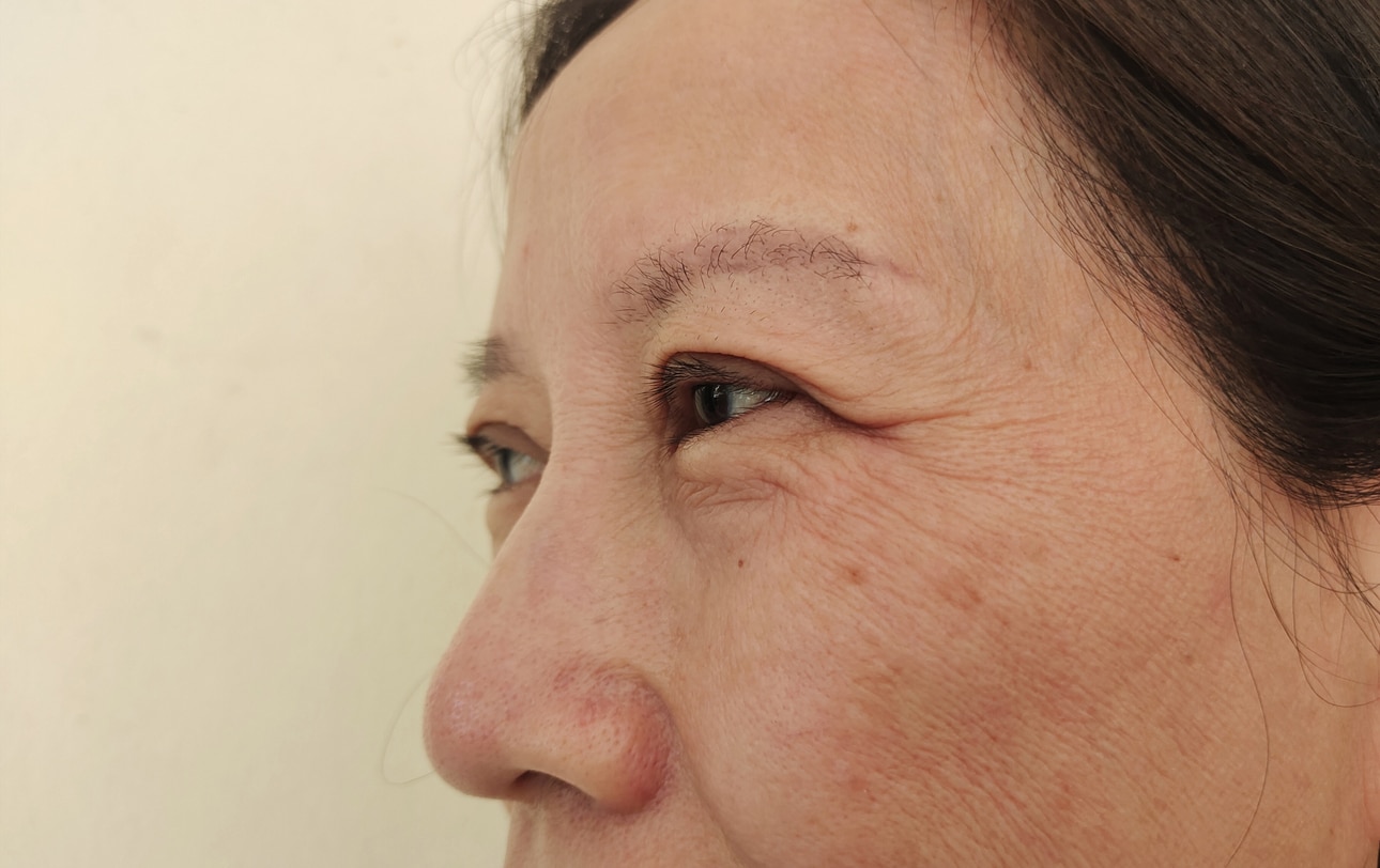Portrait showing the flabbiness adipose sagging skin under the eyes, dullness and blemishes, ptosis beside the eyelid, problem wrinkled and dark spots on the face of the woman, concept health care.