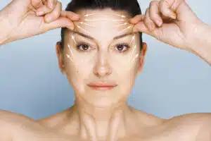 forehead lines and wrinkles