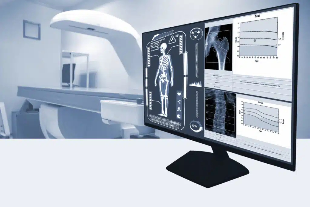 Abstract blurred photo close up examines whole body bone density images of patient during a health check and consultation.Selective focus image