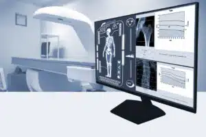 Abstract blurred photo close up examines whole body bone density images of patient during a health check and consultation.Selective focus image