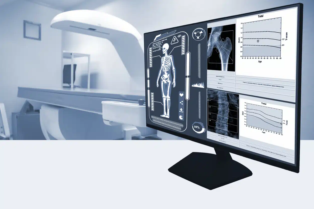 Abstract blurred photo close up examines whole body bone density images of patient during a health check and consultation.Selective focus image