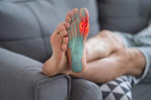 Gout attack in foot, painful joints