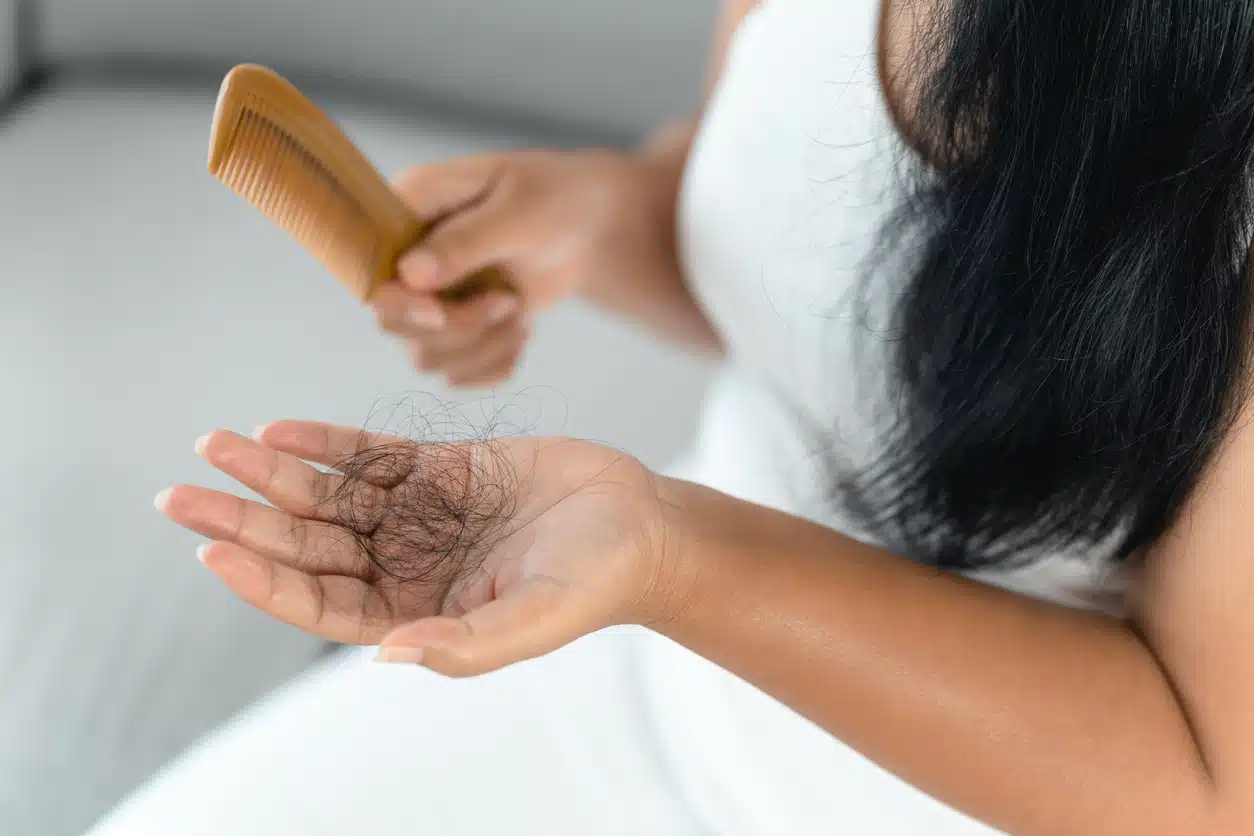 Hair loss, losing hair