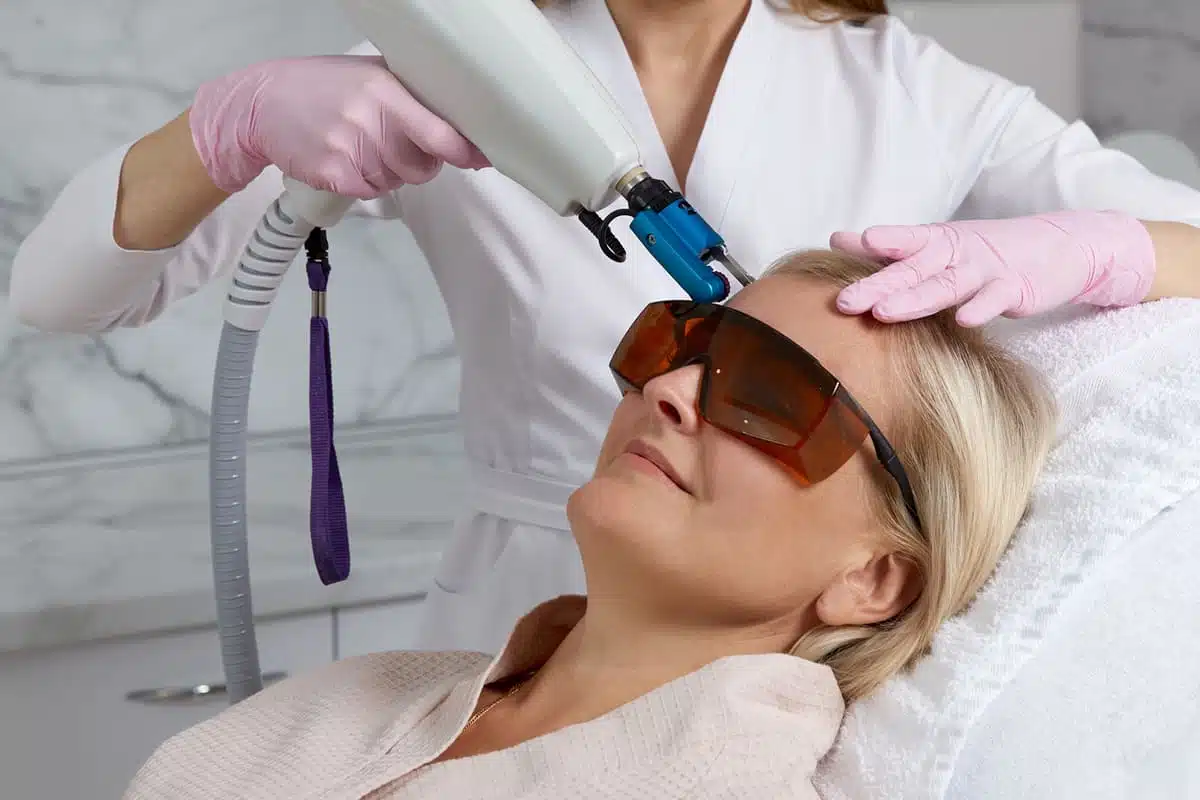 Adult acne laser treatmnet