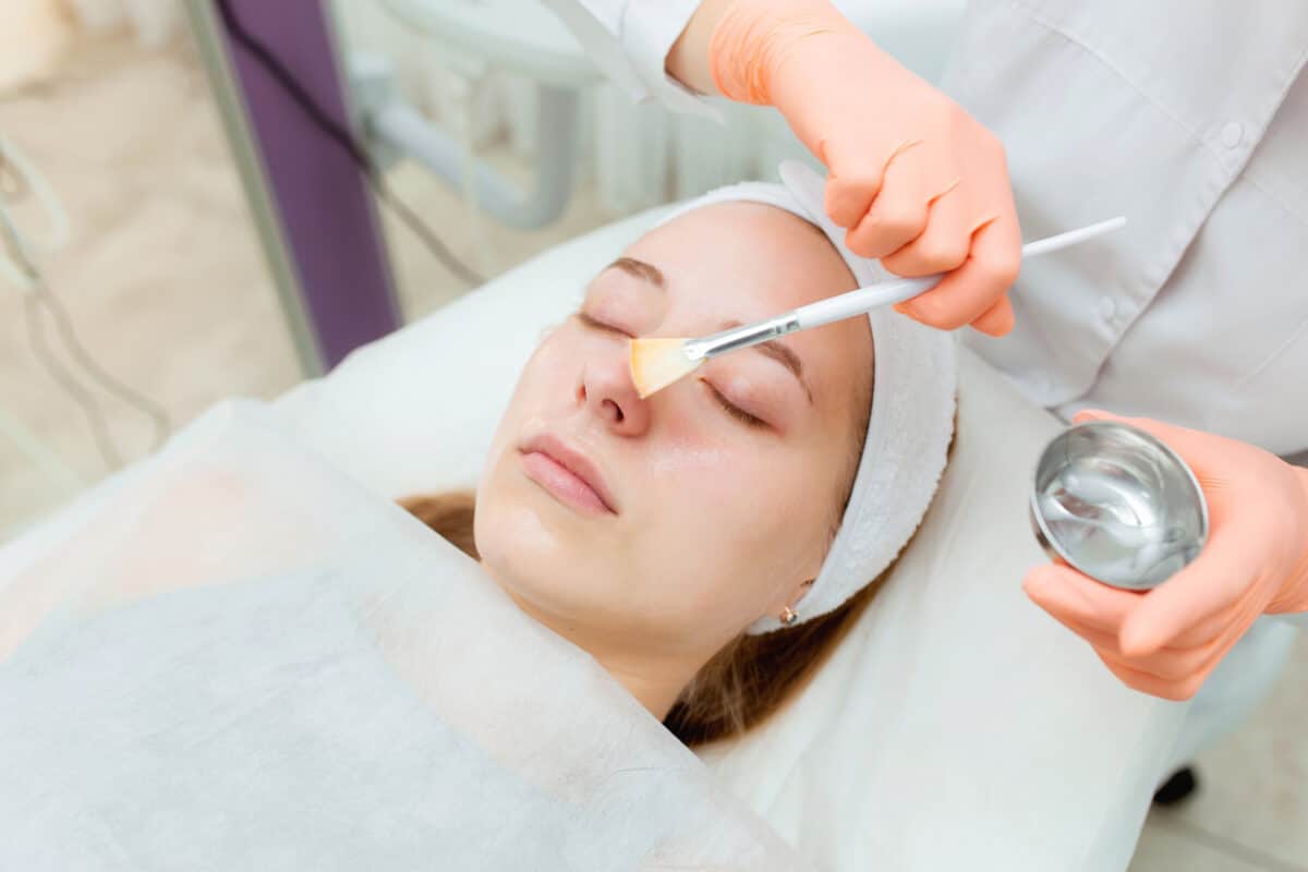 Chemical peel
