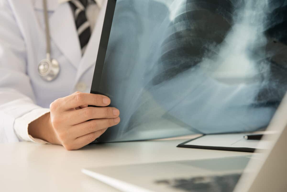 Doctor looking at an X-ray