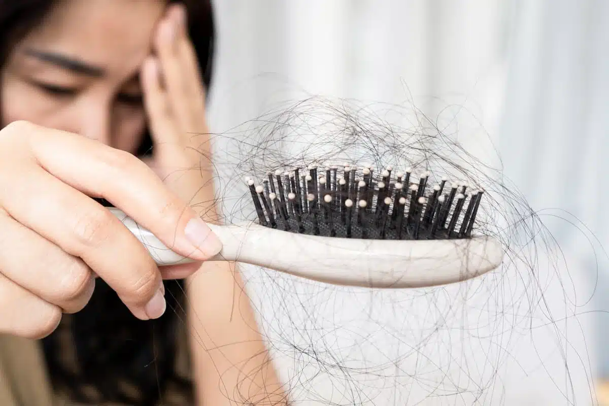 Hair loss