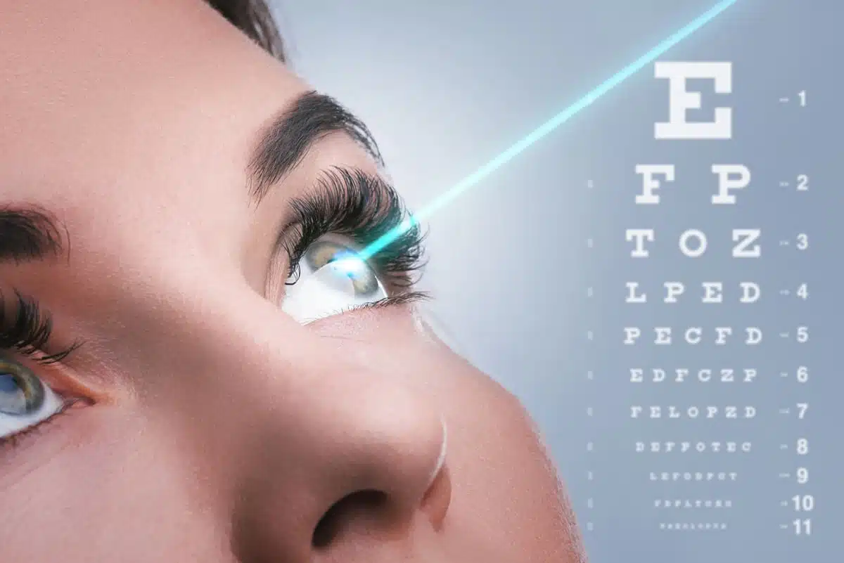 Lasik representation