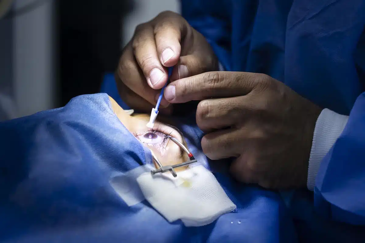 Sealing lasik surgery