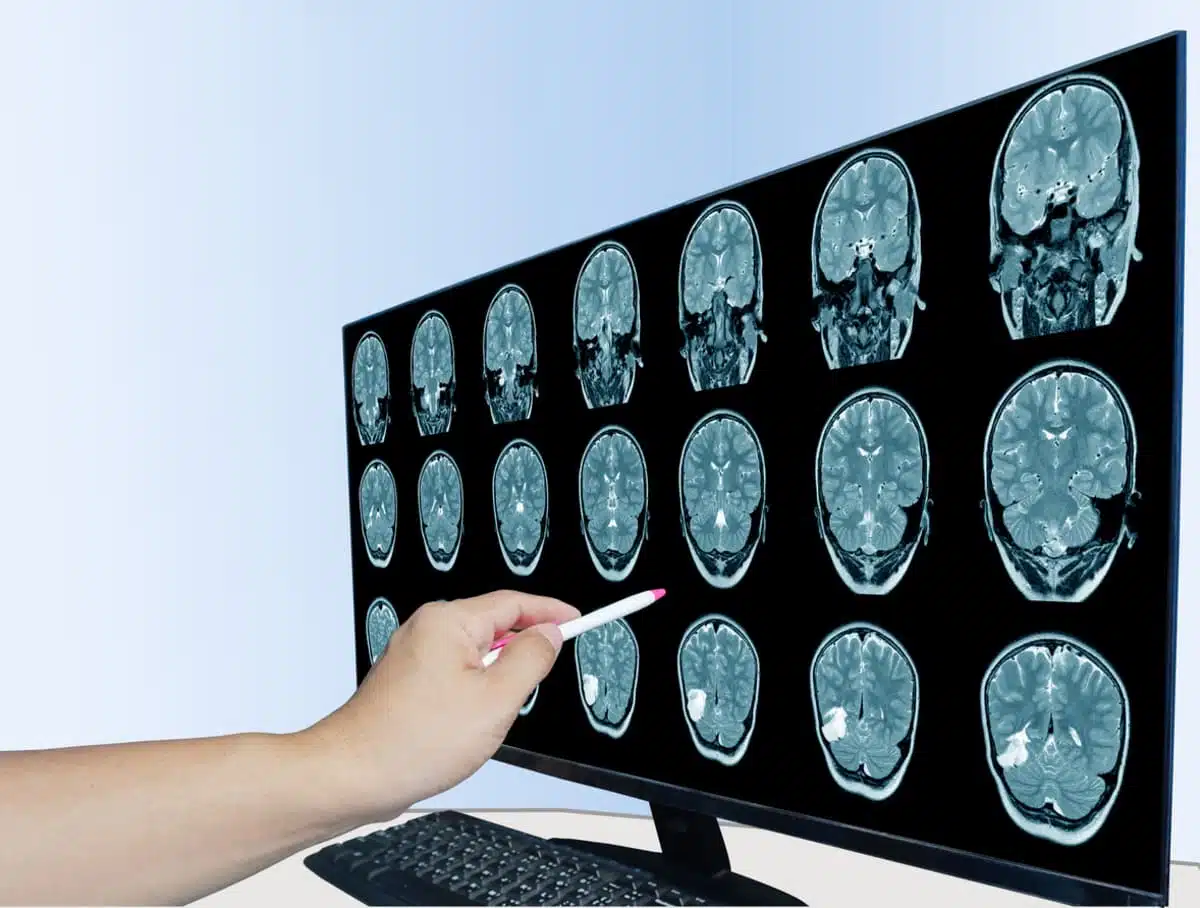 brain scan