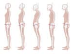 Six Ways To Improve Your Posture And Your Health