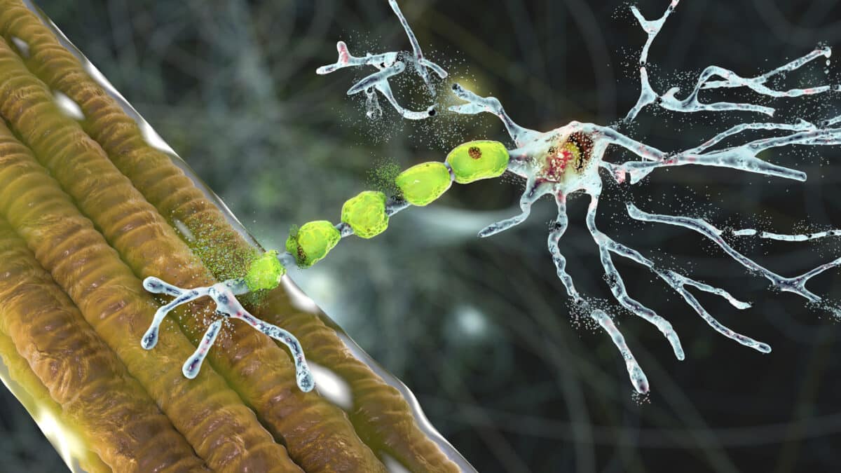 Degradation of motor neurons