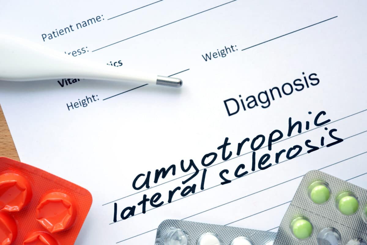 ALS diagnosis; Amyotrophic lateral sclerosis