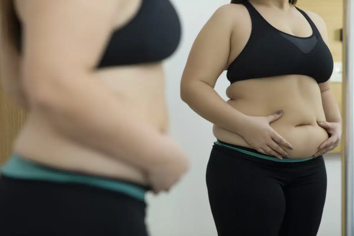 Belly fat, stomach fat, weight loss
