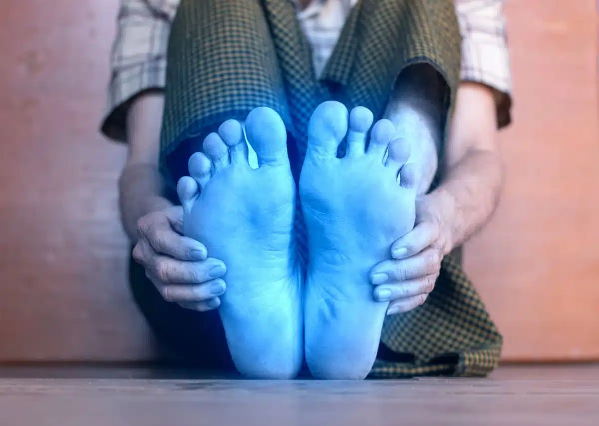 cold feet
