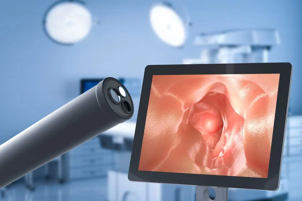 3D endoscope