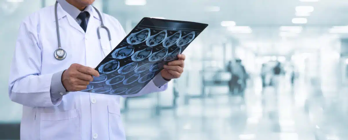 Doctor looking at X-ray, MRI, etc.