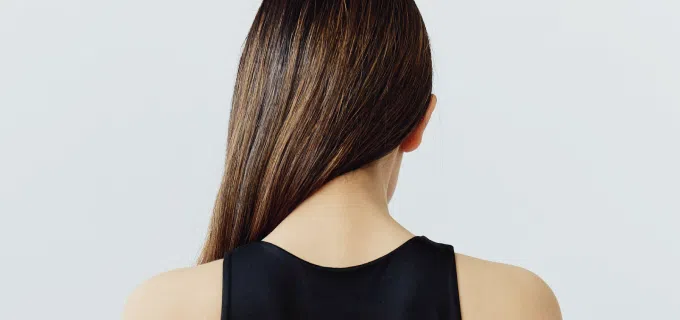 Hair loss, thicker hair, rear view