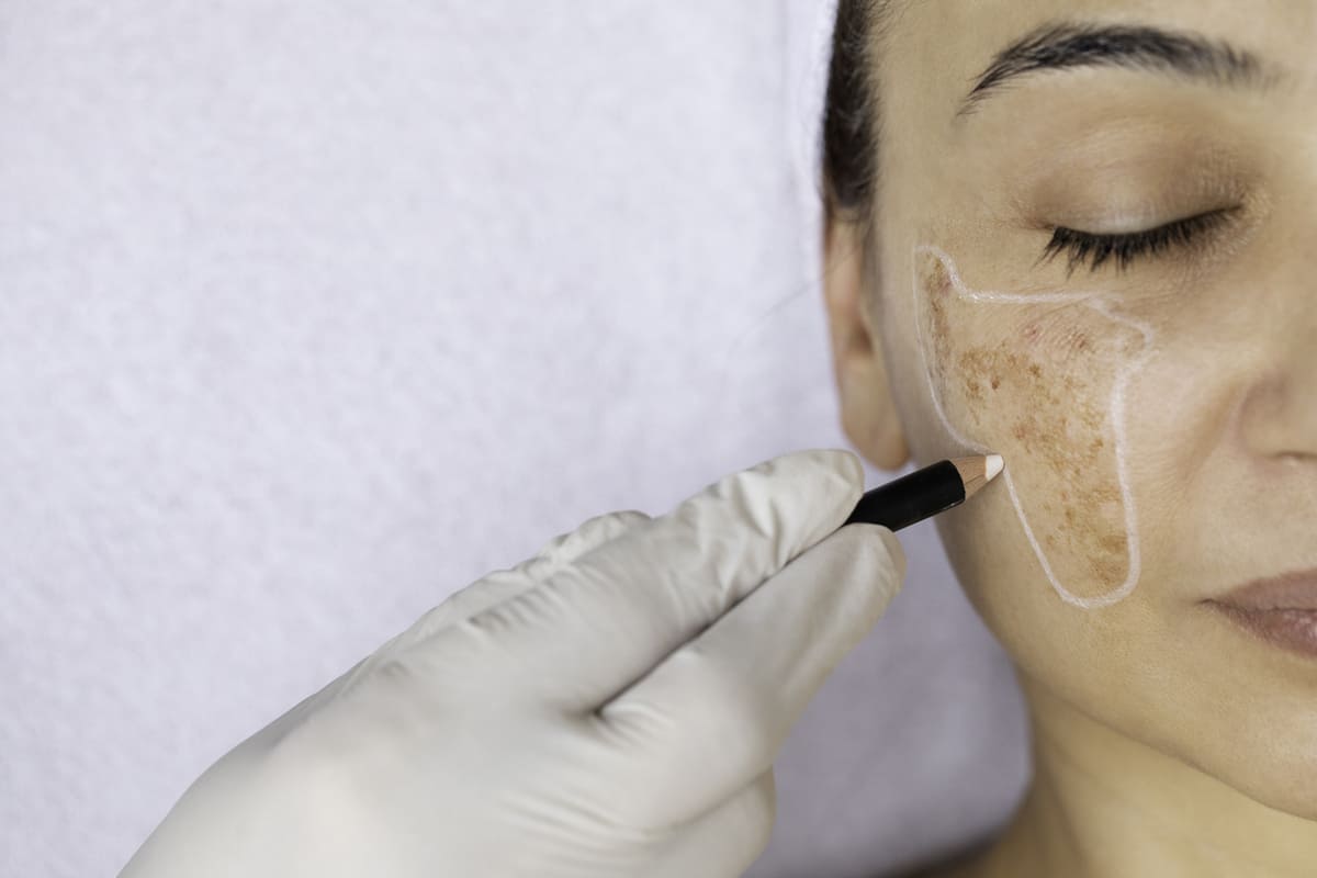 Dermatologist pigment issues skin